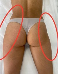 Продам аппарат для похудения Liposphere\сферотерапия