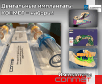 Дентальные имплантаты КОНМЕТ - наборы!