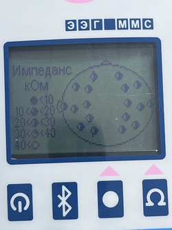 ЭЭГ-холтер Неврополиграф