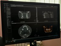 Томограф KaVo OP 300 maxio