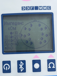 ЭЭГ-холтер Неврополиграф
