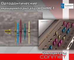 Ортодонтические миниимплантаты КОНМЕТ