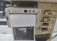 Ультразвуковой аппарат Hitachi aloka SSD 1100