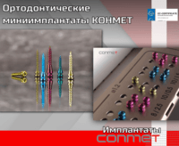 Ортодонтические миниимплантаты КОНМЕТ