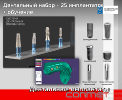 Дентальные имплантаты КОНМЕТ + 25 имплнататов – в наличии!