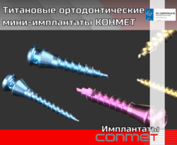 Титановые ортодонтические мини-мплантаты КОНМЕТ  Высокая прочность и биосовместимость материала