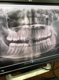 Ортопантомограф PAX 400