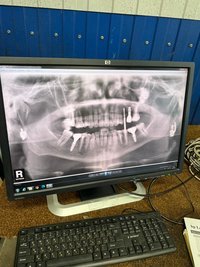 Ортопантомограф PAX 400