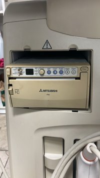 УЗИ сканер Mindray DCN6