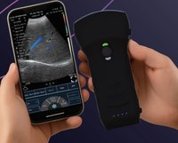 Портативный УЗИ аппарат 3 в 1