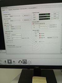 Аппарат рентгеновский дентальный 