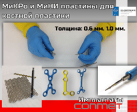 МиКРо и МиНИ пластины для костной пластики