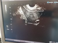 Узи сканер Toshiba Aplio MX