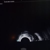 УЗИ сканер Mindray Consona N9 (демо) 2024 год выпуска