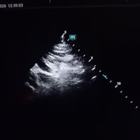 УЗИ сканер Mindray Consona N9 (демо) 2024 год выпуска