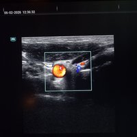 УЗИ сканер Mindray Consona N9 (демо) 2024 год выпуска