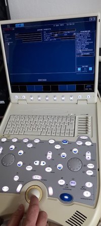 Портативный узи аппарат Esaote 7300