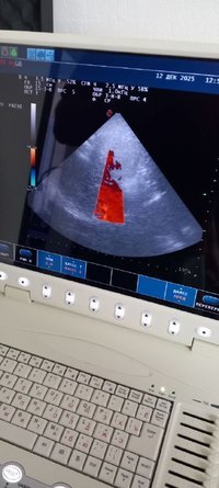 Портативный узи аппарат Esaote 7300