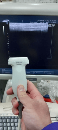 Узи-аппарат SIEMENS SONOACE x6