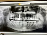 ортопантотомограф RayScan 2012г