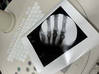 Philips BV-Pulsera 2018 года 15 кВт