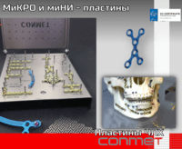 МиКРО и миНИ – пластины для остеосинтеза