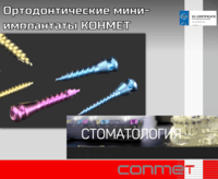 Ортодонтические титановые миниимплантаты КОНМЕТ краткая инструкция