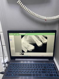 Рентгеновский аппарат hellodent Vario