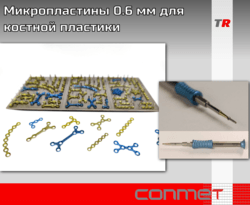Микропластины 0.6 мм для костной пластики