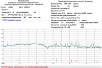 Фетальный монитор Актокардиограф эмбриональный  TOITU МТ-516 экспертного класса