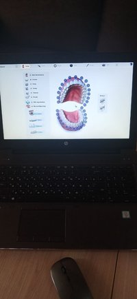 сканер интраоральный planmeca  planscan  