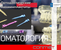 Винты ортодонтические