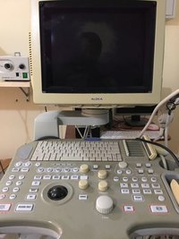 Aloka ssd 3500 УЗИ сканер целиком +  такой же на разбор  