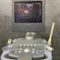 Siemens Acuson X150   датчики  на выбор   CH5-2, EC9-4, EV9-4, C5-2,   