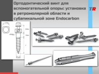 Ортодонтический винт для вспомогательной опоры: установка в ретромолярной области и субапикальной зоне В наличии!