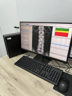Денситометр рентгеновский Medikors InAlyzer AIR