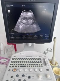 Узи аппарат Hitachi Aloka ProSound F37