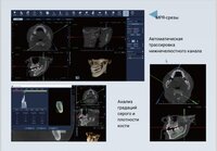 FinScan F350, КЛКТ 16х10 