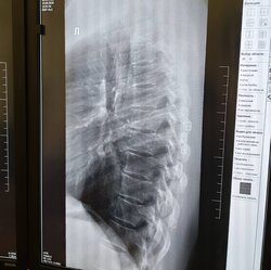  Цифровая рентгенографическая система DR-F, GE (США). 2 р.м.