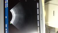 УЗИ аппарат SSI 8000 Pro