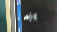 УЗИ аппарат SSI 8000 Pro