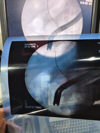 С-дуга Philips BV Pulsera + инжектор контраста США