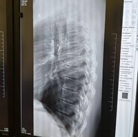  Цифровая рентгенографическая система DR-F, GE (США). 2 р.м.
