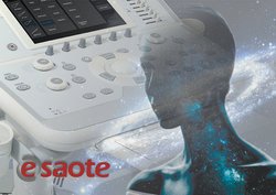 Почему врачи во всем мире выбирают Esaotе