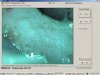 Цифровой видеокольпоскоп SLV-101