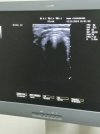 Система ультразвуковая диагностическая CHISON i7 c принадлежностями 2014 года
