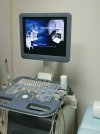  Система ультразвуковая диагностическая CHISON i7 c принадлежностями 2014 года
