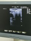  Система ультразвуковая диагностическая CHISON i7 c принадлежностями 2014 года