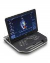 УЗИ аппарат GE Vivid IQ Premium