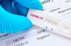 Экспресс-тест для выявления антител COVID-19 "Бейджинг Лепу Медикал Технолоджи Ко., Лтд", Китай 